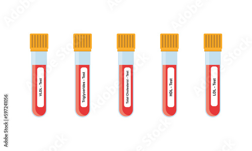 Lipid Profile Test Concept Design. Vector Illustration.	
