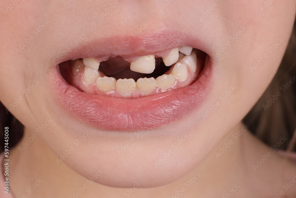Obraz premium Mouth of a child without milk teeth close-up