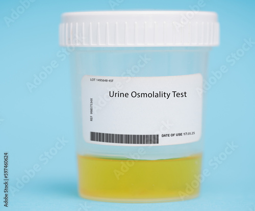 Urine osmolality test photo