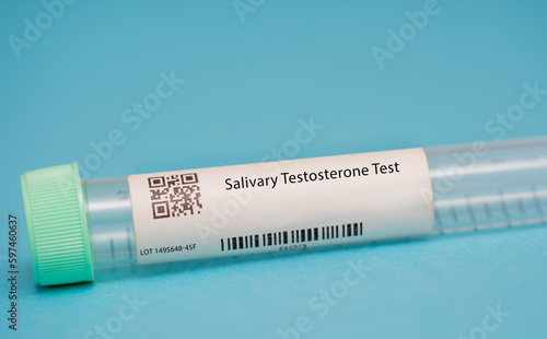 Salivary Testosterone Test