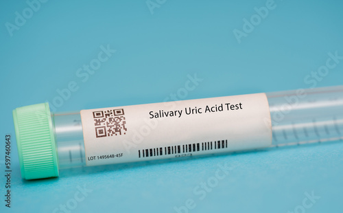 Salivary Uric Acid Test