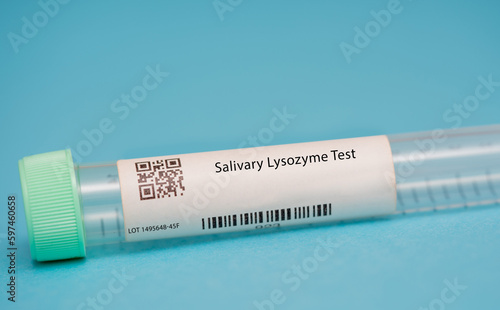 Salivary Lysozyme Test