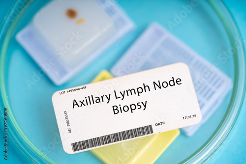 Obraz na płótnie Axillary Lymph Node Biopsy