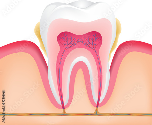 Tooth ploblem with gum disease. Dental care concept, illustration.