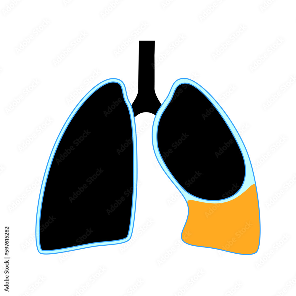 Fototapeta premium Chylothorax anatomical poster