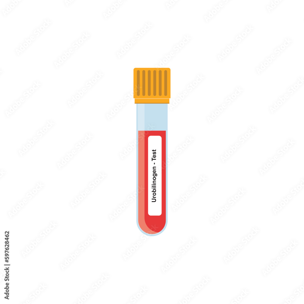 Urobilinogen Test Concept Design. Vector Illustration. Urobilinogen Test Concept Design. Vector Illustration.