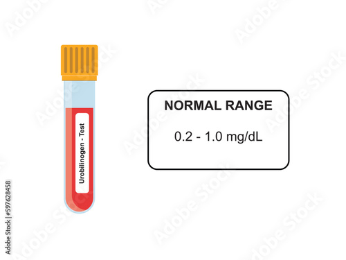 Urobilinogen Test Concept Design. Vector Illustration.
