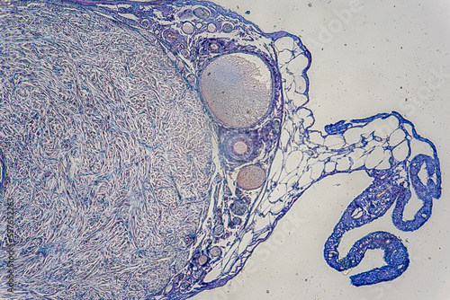 Histological Spermatic cord human, Seminal vesicle human, Prostate human and Human chromosomes under the microscope for education. photo