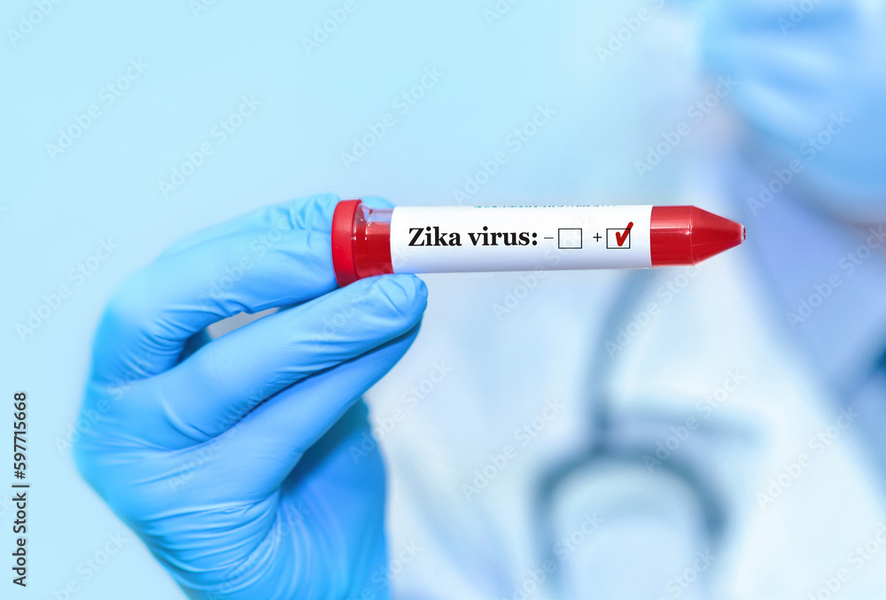 Fototapeta premium Doctor holding a test blood sample tube positive with Zika virus test