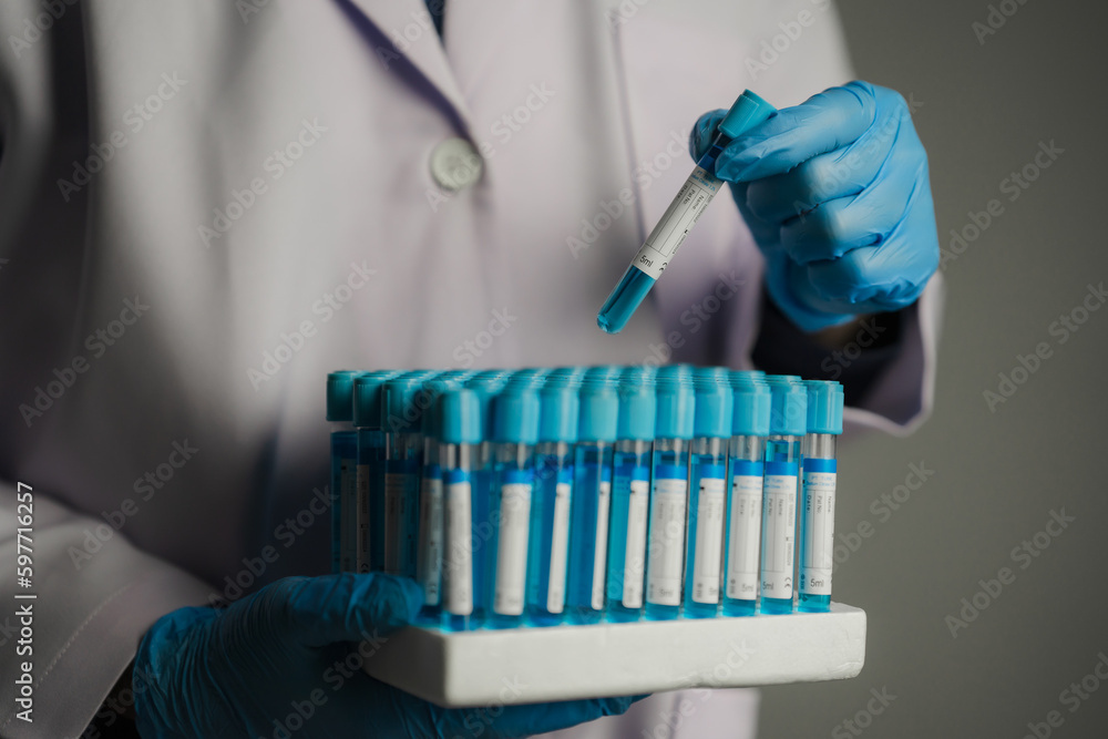 Scientist or medical in lab coat holding test tube with reagent, Laboratory glassware containing chemical liquid, Microscope, Biochemistry laboratory research Scientist or medical in lab coat holding test tube with reagent, Laboratory glassware containing chemical liquid, Microscope, Biochemistry laboratory research