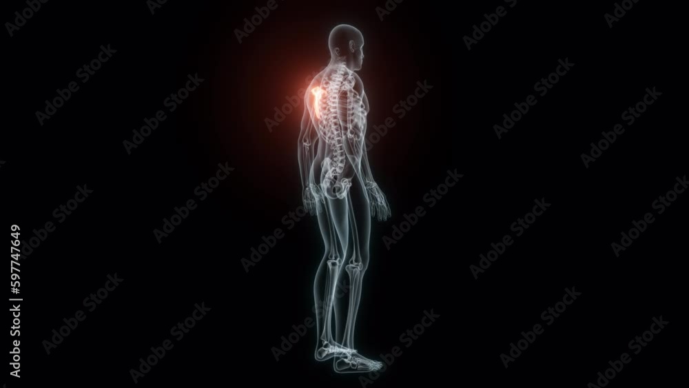 3D Rendering of a Medical Animation of the Scapula. X-ray of the Scapula.