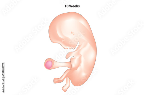 10 weeks fetus