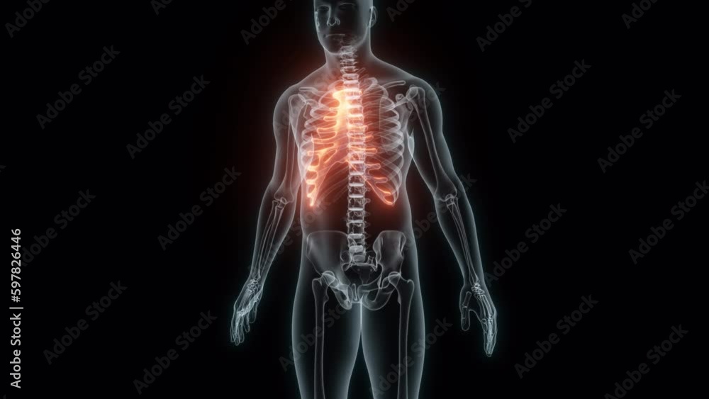 3D Rendering of a Medical Animation of the Rib cage. X-ray of the Rib cage. 3D Rendering of a Medical Animation of the Rib cage. X-ray of the Rib cage.