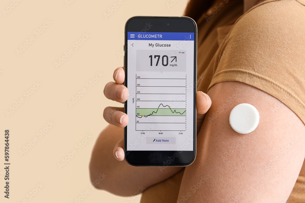 Woman with glucose sensor using mobile phone for measuring blood sugar level on beige background, closeup - obrazy, fototapety, plakaty 
