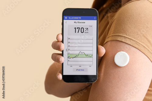 Woman with glucose sensor using mobile phone for measuring blood sugar level on beige background, closeup photo