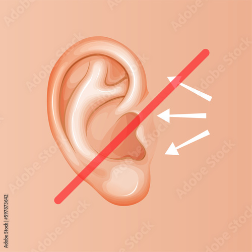 Human Ear - Hearing Loss - Stock Illustration
