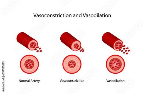 Arterial vasoconstriction and vasodilation. Cross section of arteries. Comparison of normal, constricted, and dilated blood vessels. Scientific Diagram. Vector illustration. photo