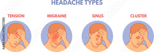 Headache types. Headaches areas infographic diagram medical poster, brain pain type in head sinus migraine tension or cluster, anatomy part of hospital patient vector illustration