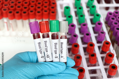 Blood type Rh negative test, blood sample to analyze in the laboratory