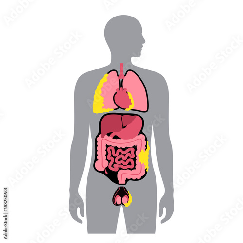 Mesothelioma tumor types Generative AI