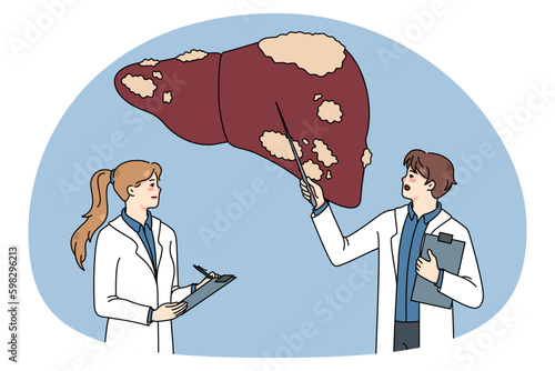 Diverse doctors in medical uniforms examine sick patient liver. Therapist make ultrasound body organ examinations. Hepatology therapy and healthcare. Flat vector illustration. Generative AI