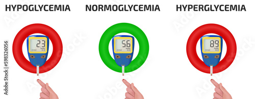 A concept for measuring mmol-l blood glucose levels. Low blood glucose, normal blood glucose, high blood sugar on the glucose meter display. Hyperglycemia, hypoglycemia, normoglycemia.