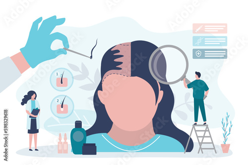 Plastic surgery, hair receding, loss problem, medical health. Tiny doctor characters around huge female head. Big hand make hair transplantation procedure.