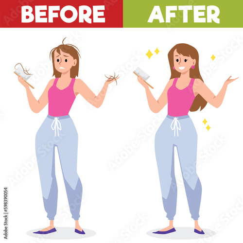 Woman before and after hair loss treatment or hair transplantation, flat vector.
