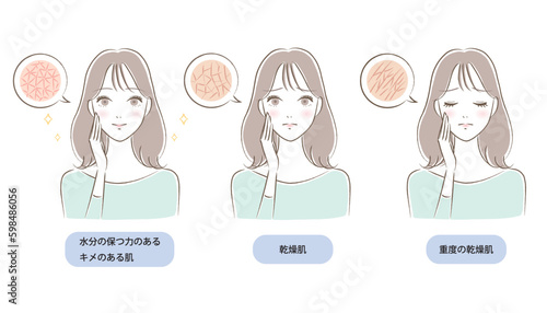 肌のキメが乾燥/潤う若い女性のイラストセット