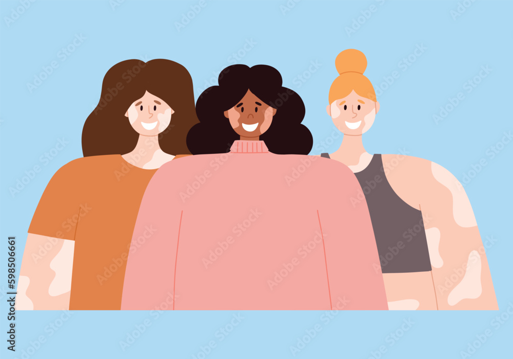 A women with vitiligo skin disease accepts her appearance, loves herself. World Vitiligo Day. vector illustration. Poster with a happy girl with vitiligo. A women with vitiligo skin disease accepts her appearance, loves herself. World Vitiligo Day. vector illustration. Poster with a happy girl with vitiligo.