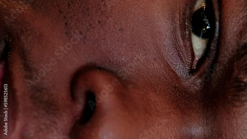 Vertical video. Skin problem. Facial care. Acne treatment. Closeup of man half face with clogged enlarged pores blackheads on cheek and nose. Generative AI photo