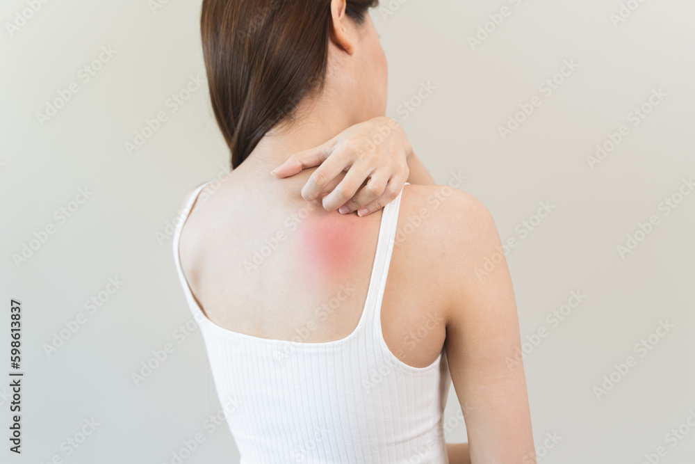 Sensitive skin allergic concept, Woman itching on her back have a red rash from allergy symptom and from scratching. Sensitive skin allergic concept, Woman itching on her back have a red rash from allergy symptom and from scratching.