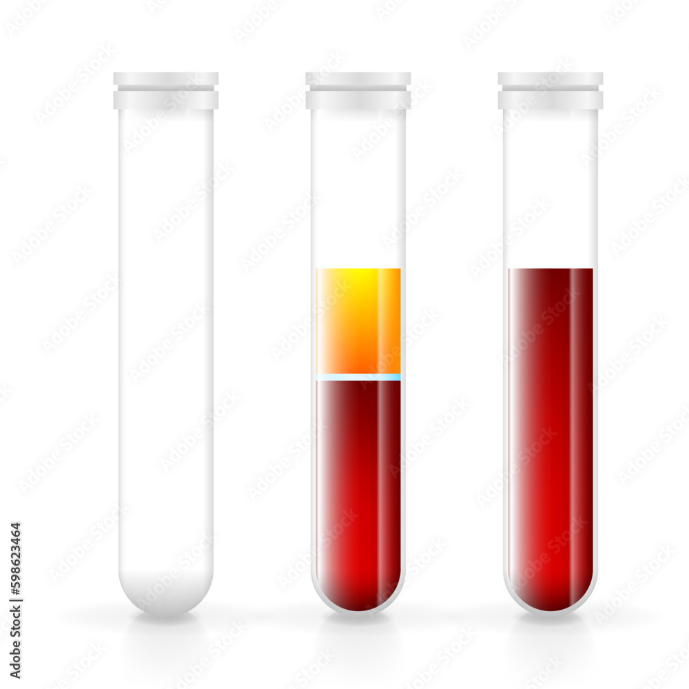 Blood in glass flasks, transfusion and testing. Laboratory and vacutainer collection tube. Medical flasks icons with blood and plasma. Vector illustration. Generative AI Blood in glass flasks, transfusion and testing. Laboratory and vacutainer collection tube. Medical flasks icons with blood and plasma. Vector illustration. Generative AI