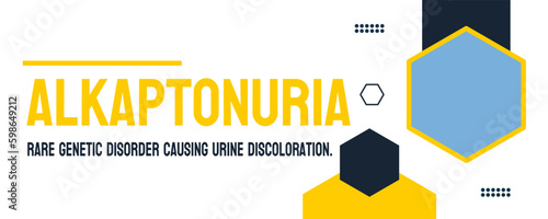 Alkaptonuria - a rare metabolic disorder