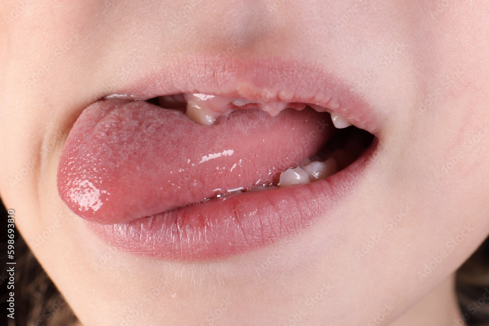 Obraz premium Child with fallen teeth showing tongue