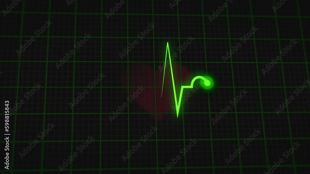 Hjertemonitor Linje Gif Line GIFs Tenor Hjertemonitor Linje Gif Line GIFs Tenor
