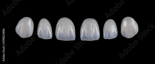 Obraz na płótnie max crowns and veneers