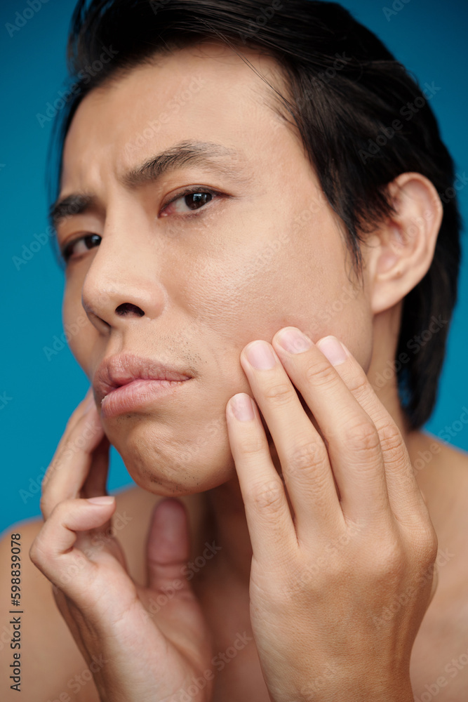 Man applying acne treatment on face after taking morning shower Man applying acne treatment on face after taking morning shower
