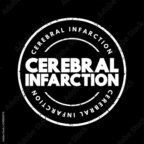 Cerebral infarction - pathologic process that results in an area of necrotic tissue in the brain, text concept for presentations and reports