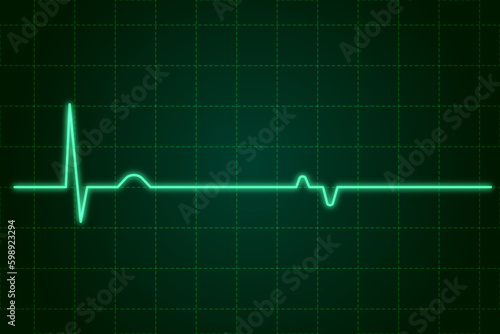 EKG monitor in intra aortic balloon pump machine in icu on blur background, Brain waves in electroencephalogram, heart rate wave