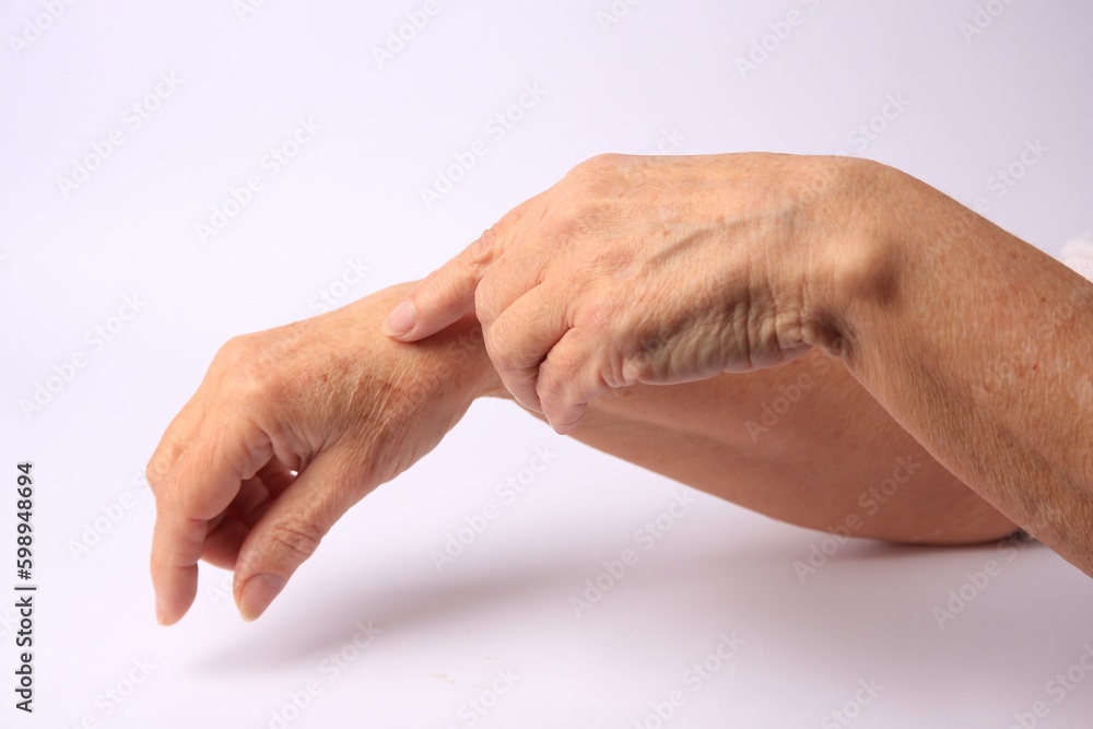 Closeup view of woman's hands with aging skin Closeup view of woman's hands with aging skin