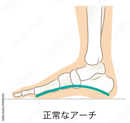 正常なアーチの足