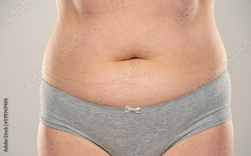 Close up of woman's fat belly, isolated on white.