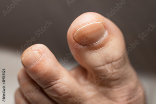 Older man feet fingers - dry skin - Shallow focus blur background