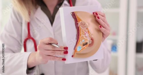 Doctor gynecologist showing anatomical model of female breast with diseases closeup 4k movie slow motion. Prevention and treatment of breast cancer concept photo