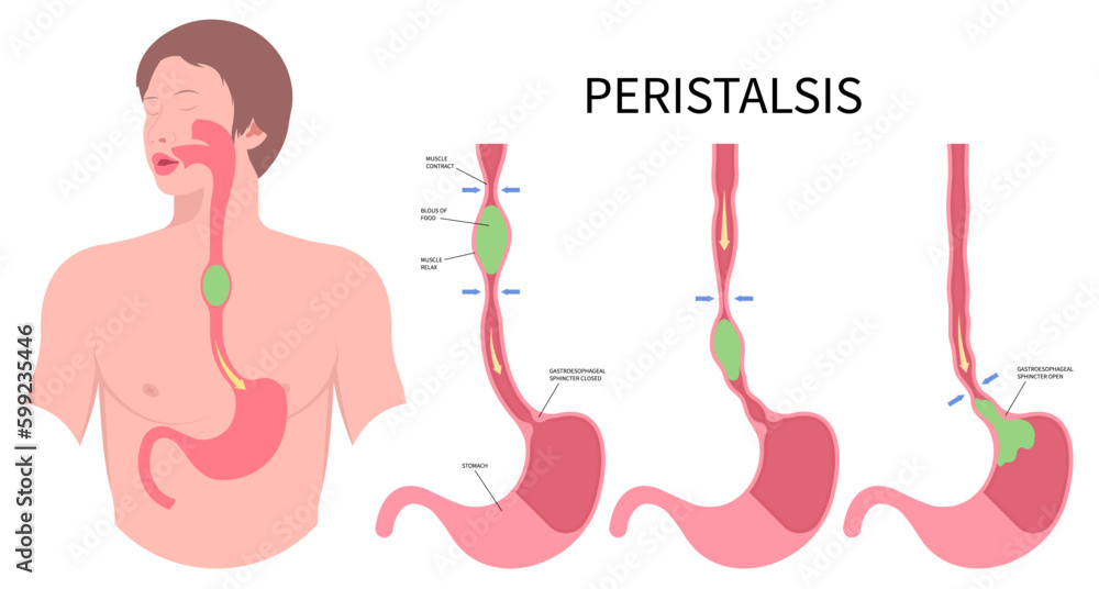 Swallow eating problem Peristalsis medical anatomy achalasia