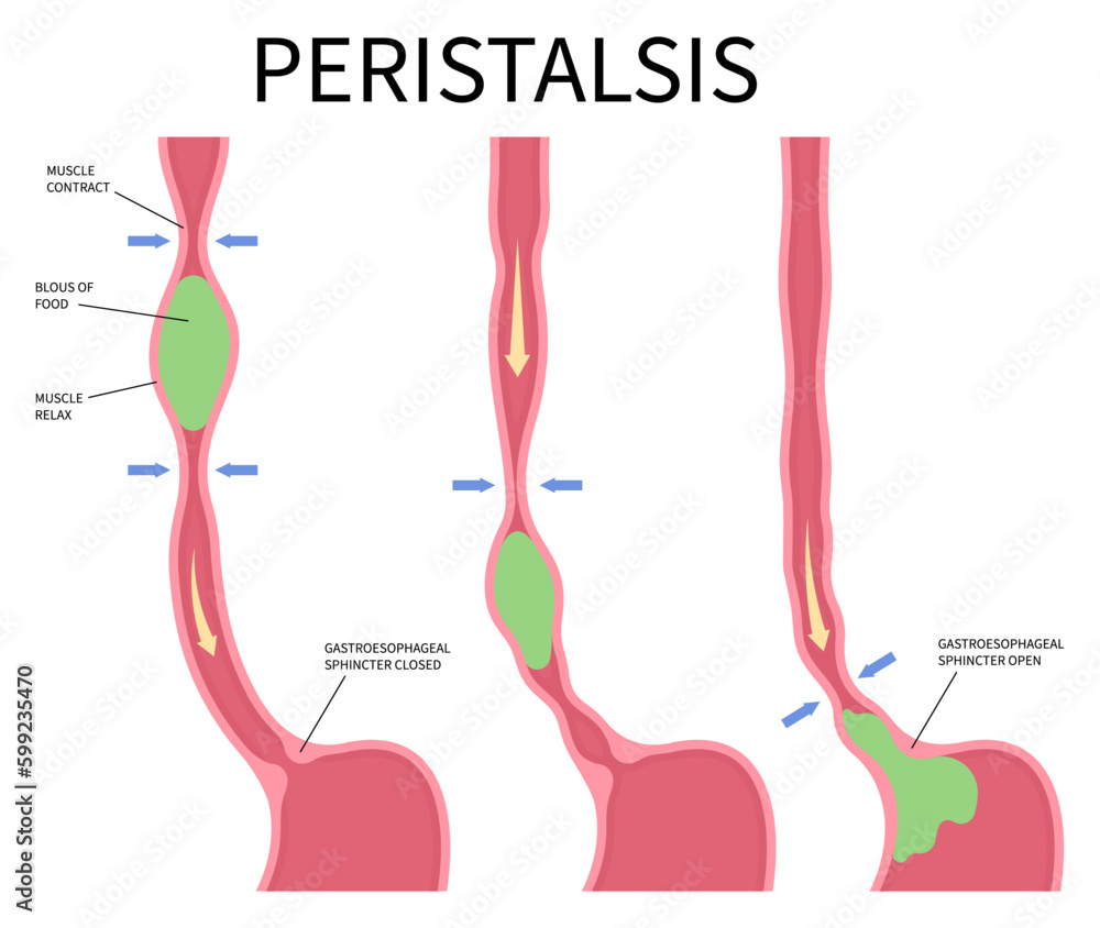 Peristalsis medical anatomy swallow eating achalasia problem