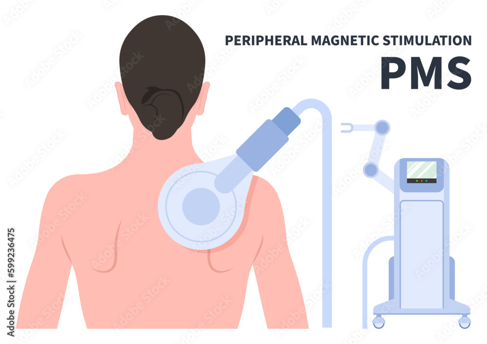 Peripheral Stimulation Therapy for De Quervain’s Disease sport