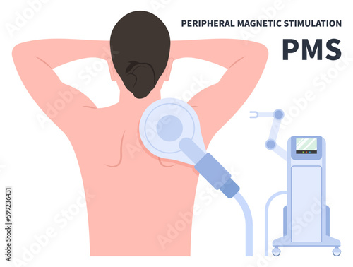 Peripheral Magnetic Stimulation Therapy for De Quervain’s Disease sport medicine Chronic Back Pain