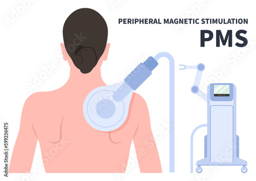 Peripheral Magnetic Stimulation Therapy for De Quervain’s Disease sport medicine Chronic Back Pain